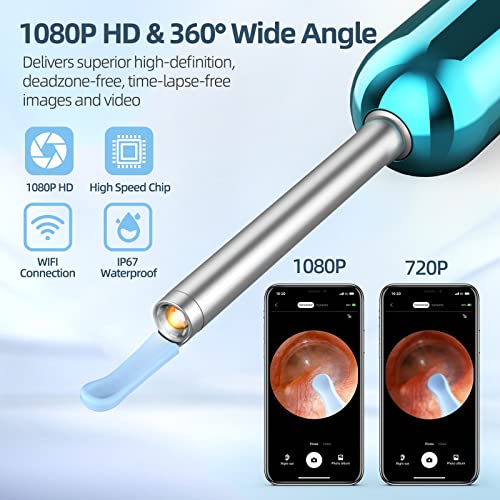 Ear Wax Removal Kit with Camera 1080P Otoscope Light 6 Ear Pick Blue P809