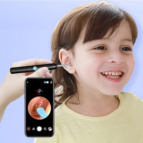 Black Wireless Ear Otoscope with Camera and 8 Pcs Ear Set T4977