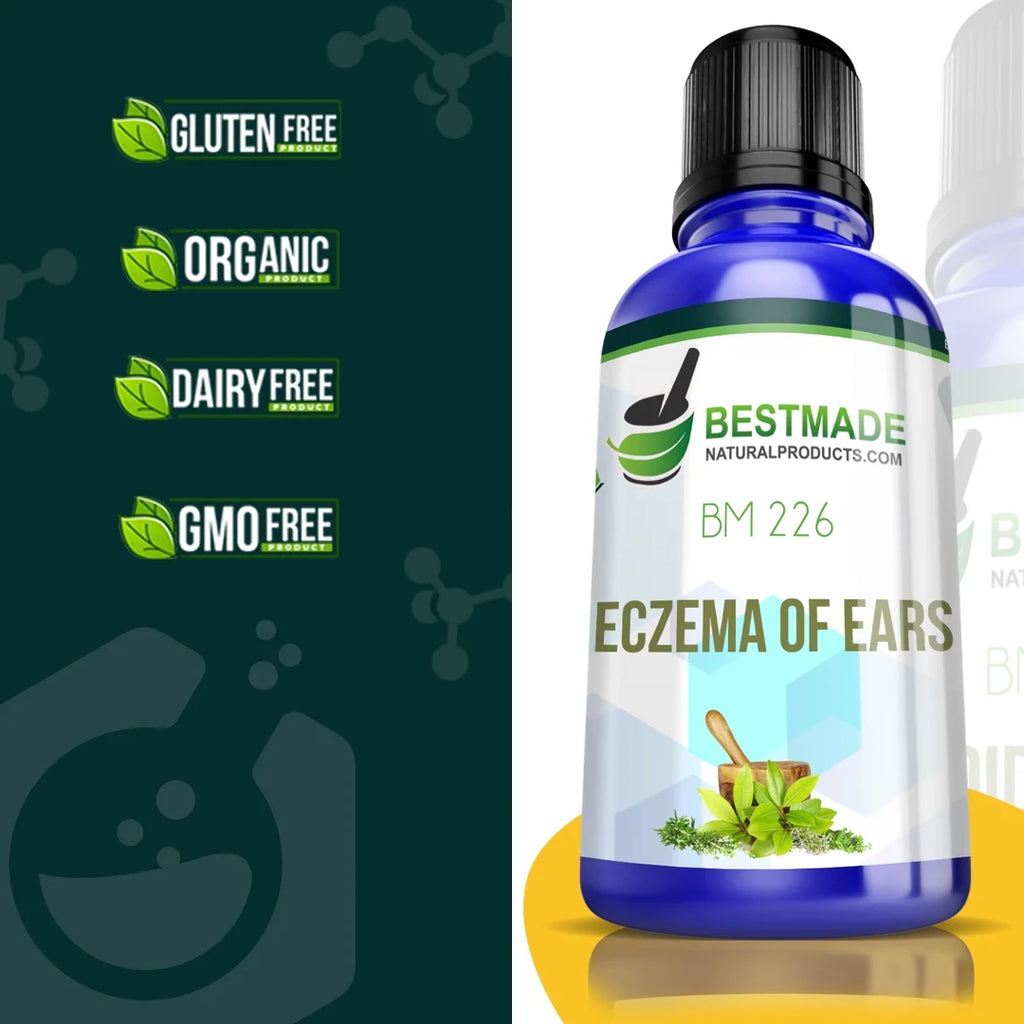 Natural Remedy for Eczema of Ears Y2814