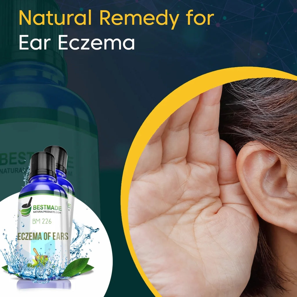 Natural Remedy for Eczema of Ears Y2814