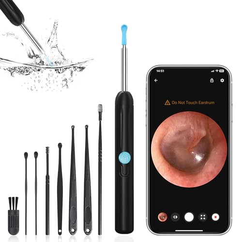Black Wireless Ear Otoscope with Camera and 8 Pcs Ear Set T4977